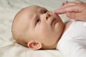 Eczema in babies