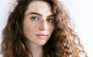 Treating freckles and pigmentation